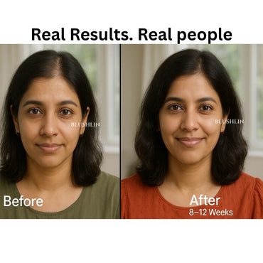 Derma Roller For Hair Growth 0.5 mm | 540 Titanium Needles | For Activates Hair Follicles, Hair Fall & Hair Thickening