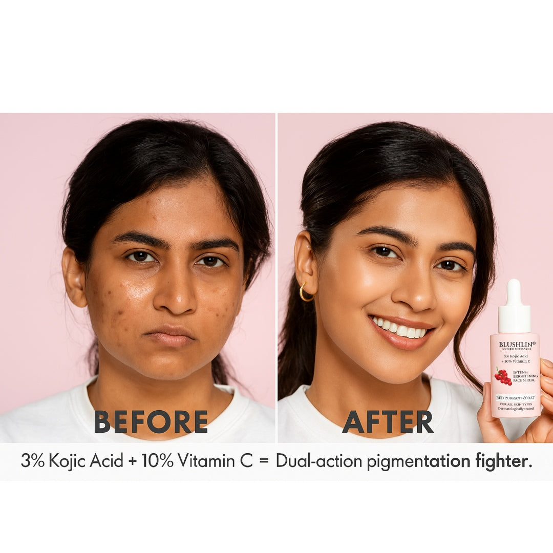 BLUSHLIN Kojic Acid Serum For Hyperpigmentation & Uneven Skin Tone