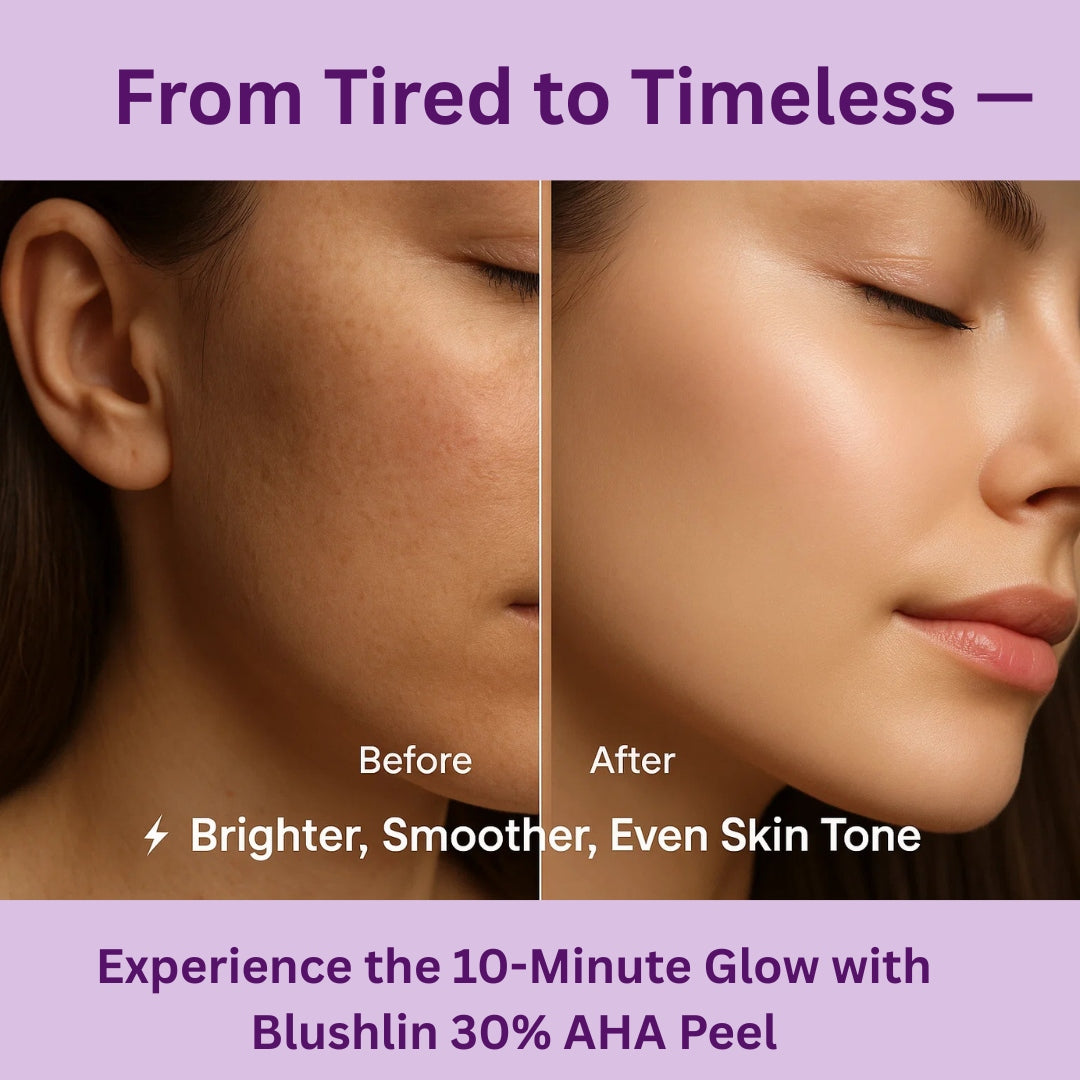 Blushlin 30% AHA Exfoliating Peel Solution for Instant 10-Minute Glow | Glycolic + Lactic + Fruit Acids | Removes Dead Skin, Reduces Tan & Pigmentation | Reveals Smooth, Radiant Skin | 30 ml