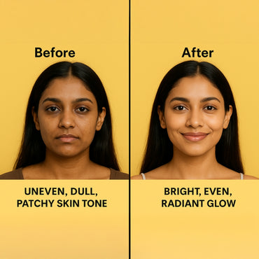 Kojic Acid + Turmeric Face Pads for Brightening & Clear Skin – Gentle Exfoliation, Calming & Refreshing Wipes for Daily Glow