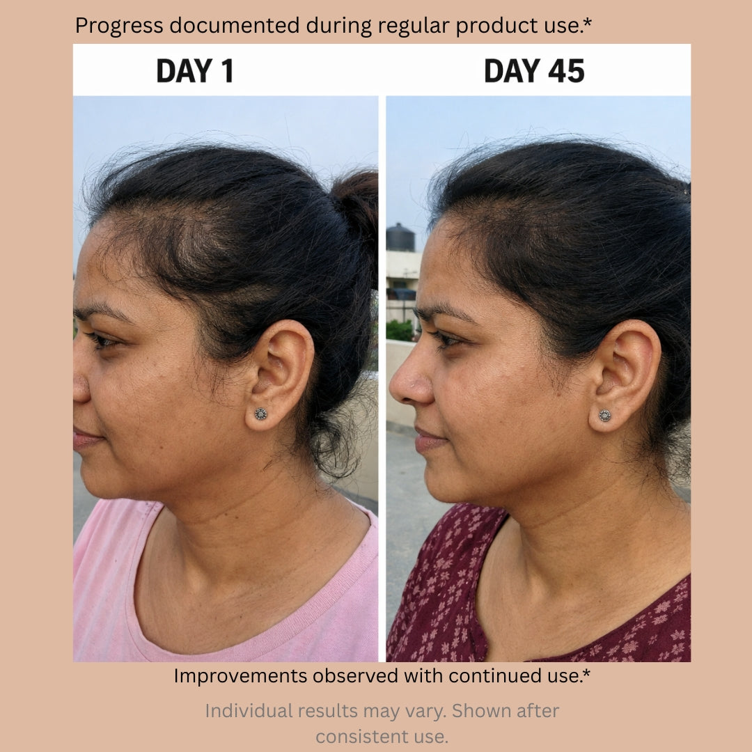 Blushlin Hair Growth Serum with Rosemary & Biotin | Strengthens Roots & Boosts Growth