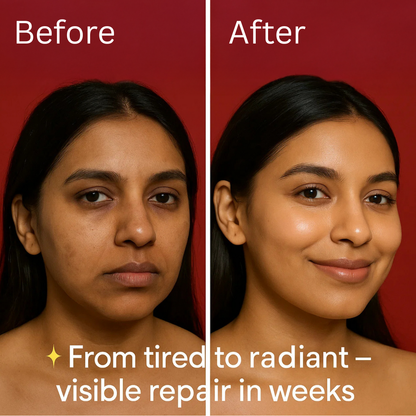 Rosehip Oil 100% Pure Cold-Pressed - for Hair & Skin | Glow, Repair & Nourish