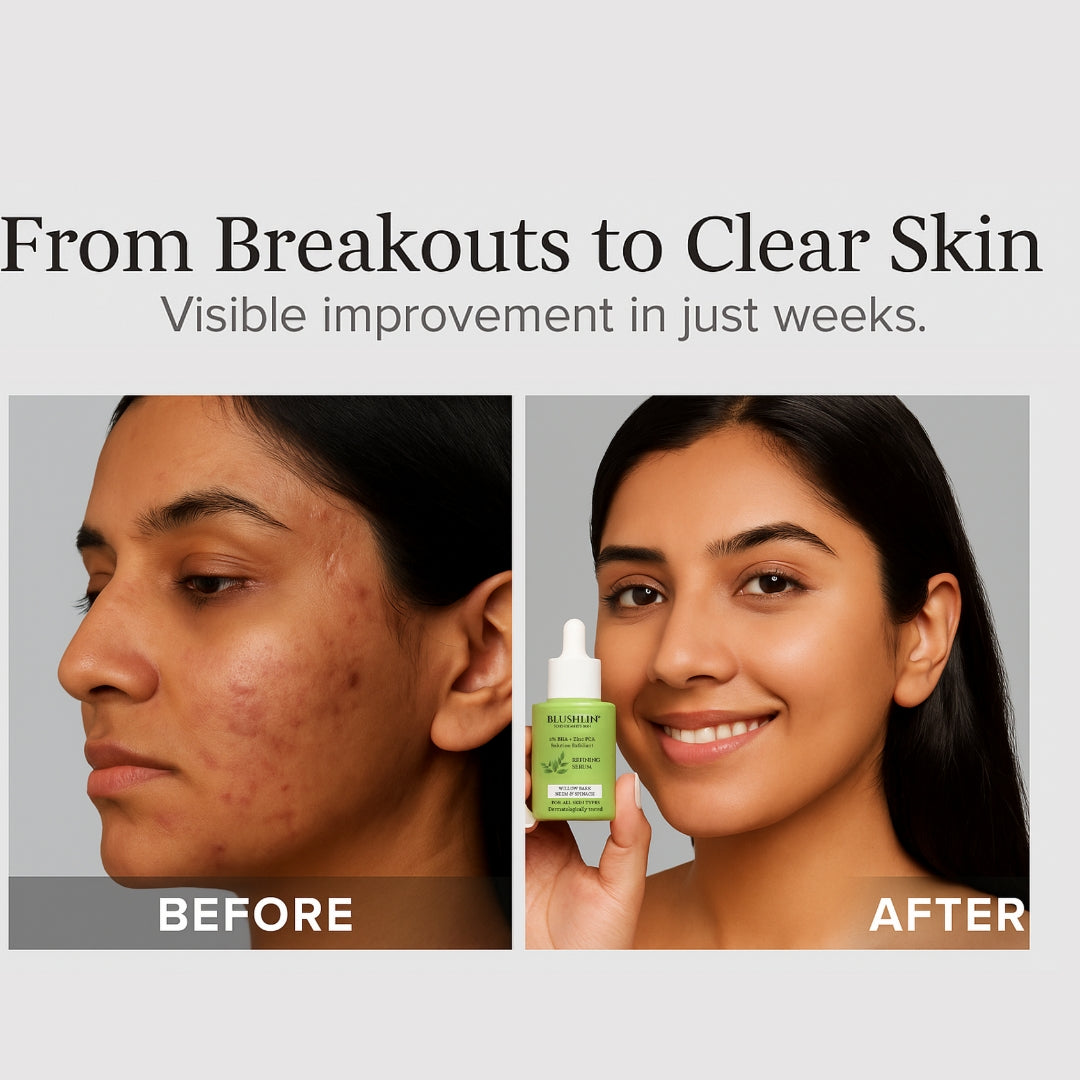 Blushlin Salicylic Acid Serum 2% with Neem, Tea Tree & Ceramidine | Fights Acne, Clears Blackheads, Controls Oil