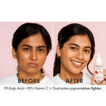 kojic acid before after
