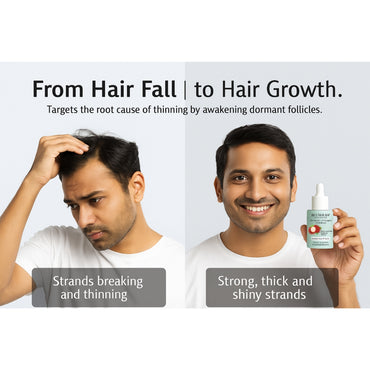 Blushlin Hair Growth Serum with Rosemary & Biotin | Strengthens Roots & Boosts Growth